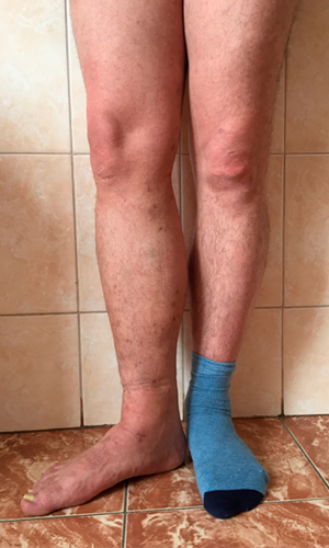 posle5s